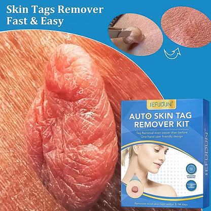 2-in-1 Skin Tag Remover Kit (2mm-8mm)