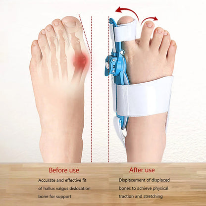 Adjustable Bunion Support Splint for Men & Women